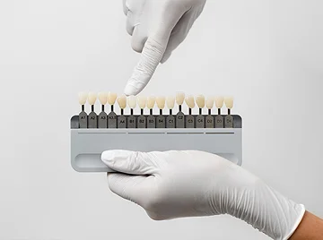Why-Do-Veneers-Turn-Yellow-Causes,-Prevention-&-Whitening-Tips-1